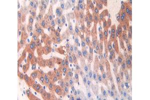 IHC-P analysis of liver tissue, with DAB staining. (CYP2E1 antibody  (AA 126-309))