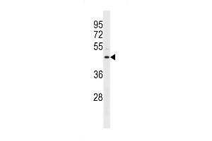 Western blot analysis in MDA-MB231 cell line lysates (35ug/lane). (ANXA8L2 antibody  (N-Term))