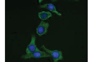 Human pancreatic carcinoma cell line MIA PaCa-2 was stained with Mouse Anti-Cytokeratin 19-FITC followed by DAPI. (Cytokeratin 19 antibody  (C-Term) (FITC))