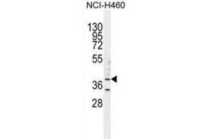 Western Blotting (WB) image for anti-UDP-Gal:betaGlcNAc beta 1,3-Galactosyltransferase, Polypeptide 5 (B3GALT5) antibody (ABIN2996041) (B3GALT5 antibody)