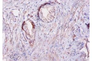 Immunohistochemistry of paraffin-embedded human prostate using CAST / Calpastatin antibody at dilution of 1:10. (Calpastatin antibody  (HRP))