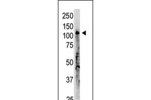 Antibody is used in Western blot to detect OAS3 in A375 lysate. (OAS3 antibody  (C-Term))