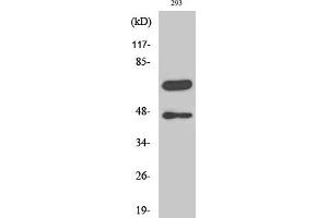 Western Blotting (WB) image for anti-Caspase 8 (CASP8) (Cleaved-Asp384) antibody (ABIN5960801) (Caspase 8 antibody  (Cleaved-Asp384))