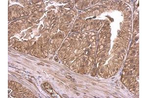 IHC-P Image Insulin Receptor antibody detects Insulin Receptor protein at membrane on mouse prostate by immunohistochemical analysis. (Insulin Receptor antibody  (C-Term))