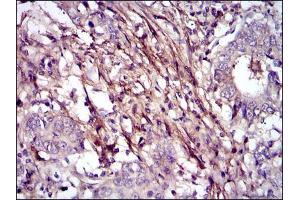 Immunohistochemistry (IHC) image for anti-Fibronectin 1 (FN1) antibody (ABIN969149)