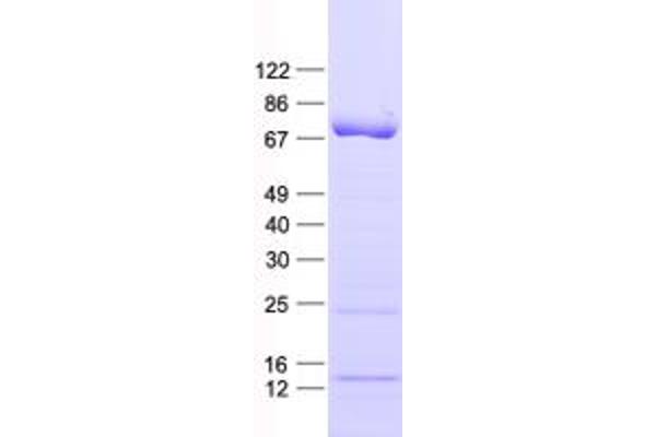 CCDC36 Protein (His tag)