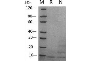 2 μg of IGF-I, Human  was resolved with SDS-PAGE under reducing (R) and non-reducing (N) conditions and visualized by Coomassie Blue staining. (IGF1 Protein (AA 49-118))