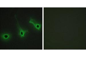 Peptide - +Immunohistochemistry analysis of paraffin-embedded human breast carcinoma tissue using Collagen V α3 antibody. (COL5A3 antibody)