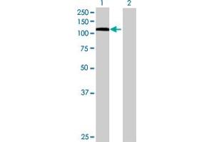 Western Blotting (WB) image for STAT6 293T Cell Transient Overexpression Lysate(Denatured) (ABIN1333597)