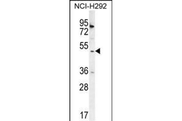 SH2D4A antibody  (N-Term)