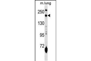Western blot analysis in mouse lung tissue lysates (35ug/lane). (Macrophage Mannose Receptor 1 antibody  (N-Term))