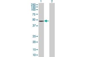 Western Blotting (WB) image for TNNT2 293T Cell Transient Overexpression Lysate(Denatured) (ABIN1333759)