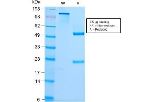 SDS-PAGE (SDS) image for anti-Spectrin, Beta, Non-erythrocytic 2 (SPTBN2) (AA 356-475) antibody (ABIN6940657)