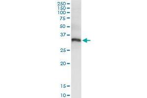 Immunoprecipitation of PYCR1 transfected lysate using rabbit polyclonal anti-PYCR1 and Protein A Magnetic Bead (PYCR1 (Human) IP-WB Antibody Pair)