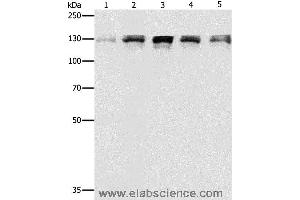 Western blot analysis of Human fetal small intestine, liver cancer and Lymphoma Lymphoma, 293T and A549 cell, using DDB1 Polyclonal Antibody at dilution of 1:500 (DDB1 antibody)