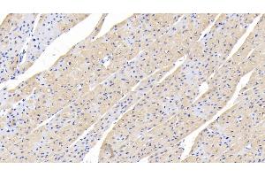 Detection of TGFb1 in Human Cardiac Muscle Tissue using Polyclonal Antibody to Transforming Growth Factor Beta 1 (TGFb1) (TGFB1 antibody  (AA 279-390))