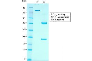 SDS-PAGE (SDS) image for anti-Cadherin-16 (CDH16) antibody (ABIN6939021)