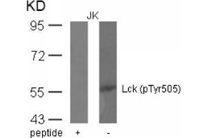 Image no. 1 for anti-Lymphocyte-Specific Protein tyrosine Kinase (LCK) (pTyr505) antibody (ABIN401552) (LCK antibody  (pTyr505))