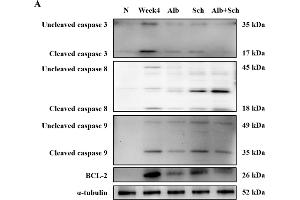 Western Blotting (WB) image for anti-B-Cell CLL/lymphoma 2 (BCL2) (N-Term) antibody (ABIN2857047)