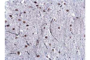 IHC-P Image CBX1 / HP1 beta antibody detects CBX1 / HP1 beta protein at nucleus on mouse middle brain by immunohistochemical analysis. (CBX1 antibody  (Center))