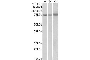 Western Blotting (WB) image for anti-Kelch-Like 6 (KLHL6) antibody (ABIN5924763) (KLHL6 antibody)