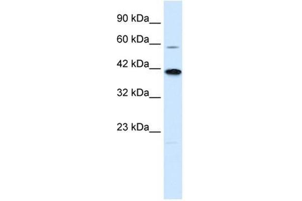 KCNK13 Antikörper  (C-Term)