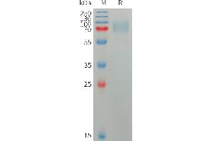 PLXDC2 Protein (AA 31-453) (His tag)