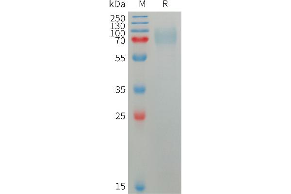 PLXDC2 Protein (AA 31-453) (His tag)