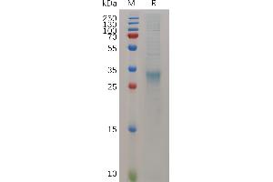 Mouse I Protein, His Tag on SDS-PAGE under reducing condition. (IFNB1 Protein (AA 22-182) (His tag))
