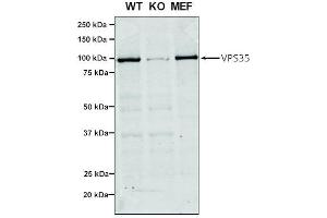 Western Blot analysis of Human, Mouse A549, MEF showing detection of VPS35 protein using Mouse Anti-VPS35 Monoclonal Antibody, Clone 7E4 (ABIN6932908). (VPS35 antibody)