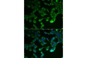 Immunofluorescence analysis of HeLa cell using C1R antibody. (C1R antibody)