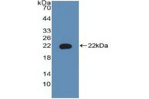 Western blot analysis of recombinant Human BAD. (BAD antibody  (AA 1-168))