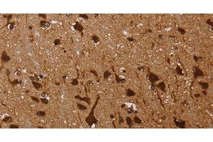 Immunohistochemistry of paraffin-embedded Human brain using KARS Polyclonal Antibody at dilution of 1:60 (KARS antibody)