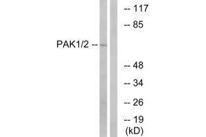 Western blot analysis of extracts from K562 cells, using PAK1/2 (Ab-199) antibody. (PAK1 antibody  (Ser199))