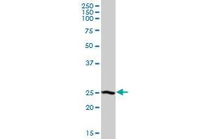 DCXR MaxPab polyclonal antibody. (DCXR antibody  (AA 1-244))