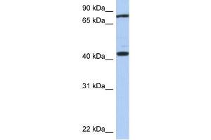 TEX9 antibody used at 1 ug/ml to detect target protein. (TEX9 antibody  (Middle Region))