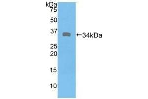 Detection of Recombinant DMD, Human using Polyclonal Antibody to Dystrophin (DMD) (Dystrophin antibody  (AA 3048-3328))