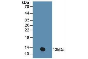 Figure. (PKIB antibody  (AA 8-76))