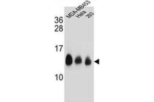 Western Blotting (WB) image for anti-NADH Dehydrogenase (Ubiquinone) 1, Subcomplex Unknown, 2, 14.5kDa (NDUFC2) antibody (ABIN2995814) (NDUFC2 antibody)