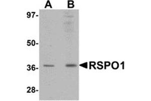 Western Blotting (WB) image for anti-R-Spondin 1 (RSPO1) (N-Term) antibody (ABIN1031546) (RSPO1 antibody  (N-Term))