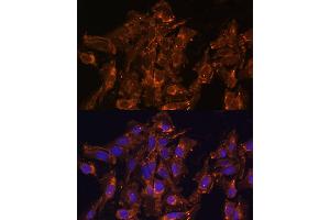 Immunofluorescence analysis of U-2 OS cells using HSD17B8 Polyclonal Antibody  at dilution of 1:100 (40x lens). (HSD17B8 antibody  (AA 1-261))