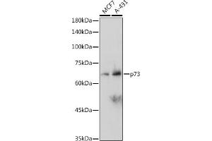 Western blot analysis of extracts of various cell lines, using p73 antibody (ABIN1678945, ABIN1678944, ABIN7101487 and ABIN7101488) at 1:1000 dilution. (Tumor Protein p73 antibody)