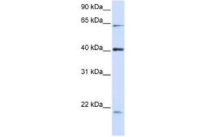 C19ORF46 antibody used at 1 ug/ml to detect target protein. (C19orf46 antibody  (N-Term))