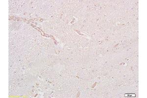 Immunohistochemistry (Paraffin-embedded Sections) (IHC (p)) image for anti-Glucagon-Like Peptide 1 Receptor (GLP1R) (AA 101-200) antibody (ABIN731333)