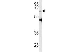 Western blot analysis of PRMT5 antibody and HL-60 lysate (PRMT5 antibody  (AA 473-499))