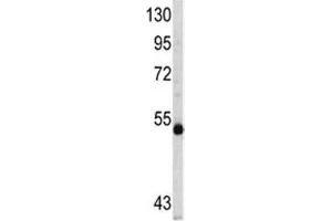 Western blot analysis of MYCN antibody and CEM lysate (MYCN antibody  (AA 322-351))