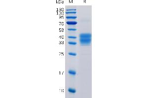 Human CD52 Protein, mFc Tag on SDS-PAGE under reducing condition. (CD52 Protein (CD52) (AA 25-36) (mFc Tag))