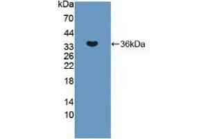 Western blot analysis of recombinant Human ERN1. (ERN1 antibody  (AA 571-832))