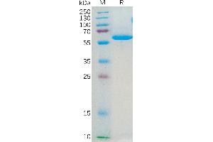 Human JAM-A Protein, hFc Tag on SDS-PAGE under reducing condition. (F11R Protein (AA 28-238) (Fc Tag))