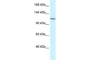 Western Blot showing PKN2 antibody used at a concentration of 1 ug/ml against 293T Cell Lysate (PKN2 antibody  (C-Term))